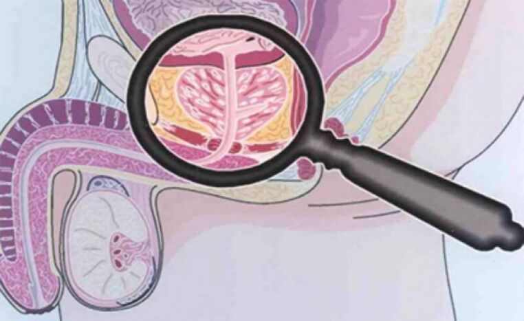 The prostate and its position