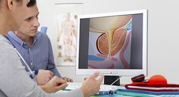 diagnosing prostatitis in men