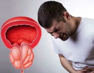 The symptoms of chronic prostatitis in men